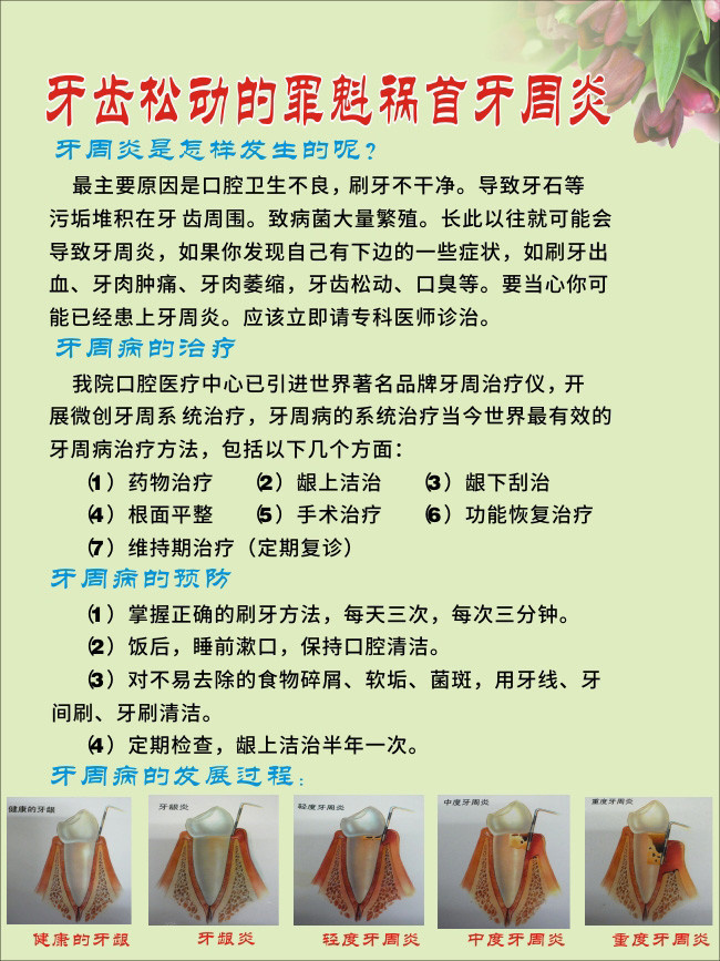 牙周炎知识挂图